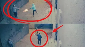 طلقة خرطوش بالقليوبية.. القصة الكاملة لفقدان طفل قدمه في حادث مأساوي باسوس